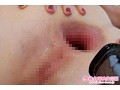 超ド級の全開アナル Vol.1 ～秘蔵シーン、蔵出しぽっかり尻穴～