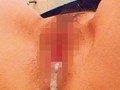 AVOPEN2016！ お見舞いに来た彼女が入院先の同部屋にいる極道のおじさんにデカチン（真珠入り）を見せられ寝取られた話「彼女を驚かせようとベッドの下に隠れていたら…」