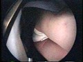 JKつけまわしパンチラDX （DOD）