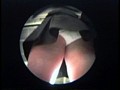 JKつけまわしパンチラDX 3 （DOD）