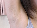 腋