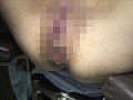 衝撃流出！麻酔レイプ ある麻酔医の記録