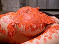 重度のフィスト中毒！ロウソクプレイ依存！緊急手術が必要な末期の変態症！ 泌尿器科勤務の現役マゾ美人女医がAVデビュー！ 永瀬双葉