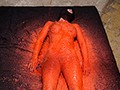 重度のフィスト中毒！ロウソクプレイ依存！緊急手術が必要な末期の変態症！ 泌尿器科勤務の現役マゾ美人女医がAVデビュー！ 永瀬双葉