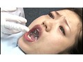 歯医者でごっくん